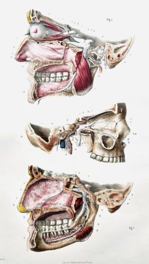 BOURGERY (Jean-Marc). [Atlas d'anatomie et chirurgie dentaires].